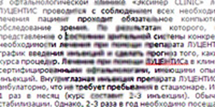 Центральная скотома в искаженном виде